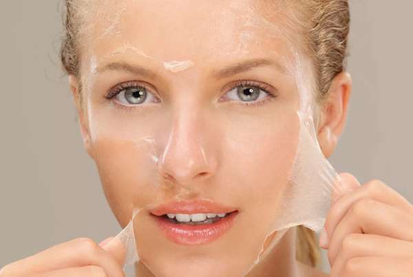 Chemical Peel