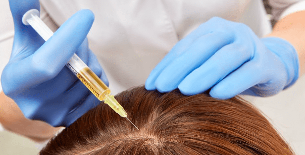 What Is Hair PRP?