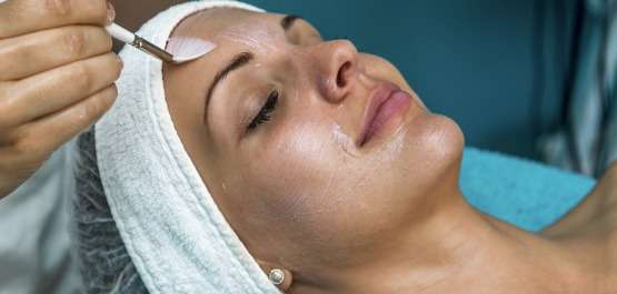 What is Chemical Peel?