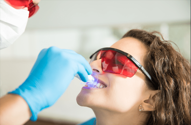 The Ultimate Guide to Teeth Whitening at Cosmothetics