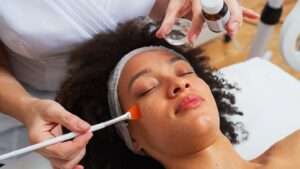 Transform Your Skin with Chemical Peels