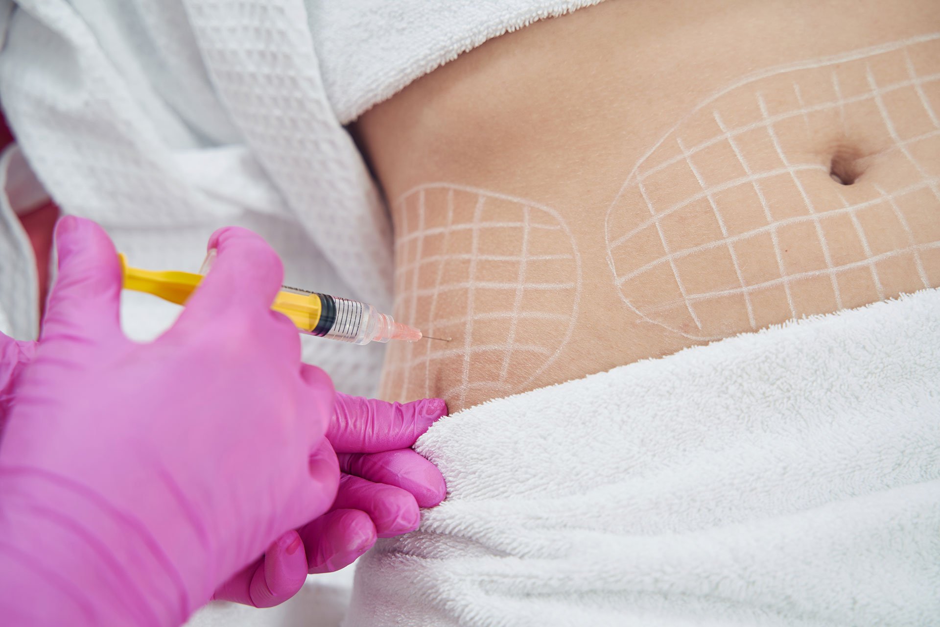 Fat dissolving injections