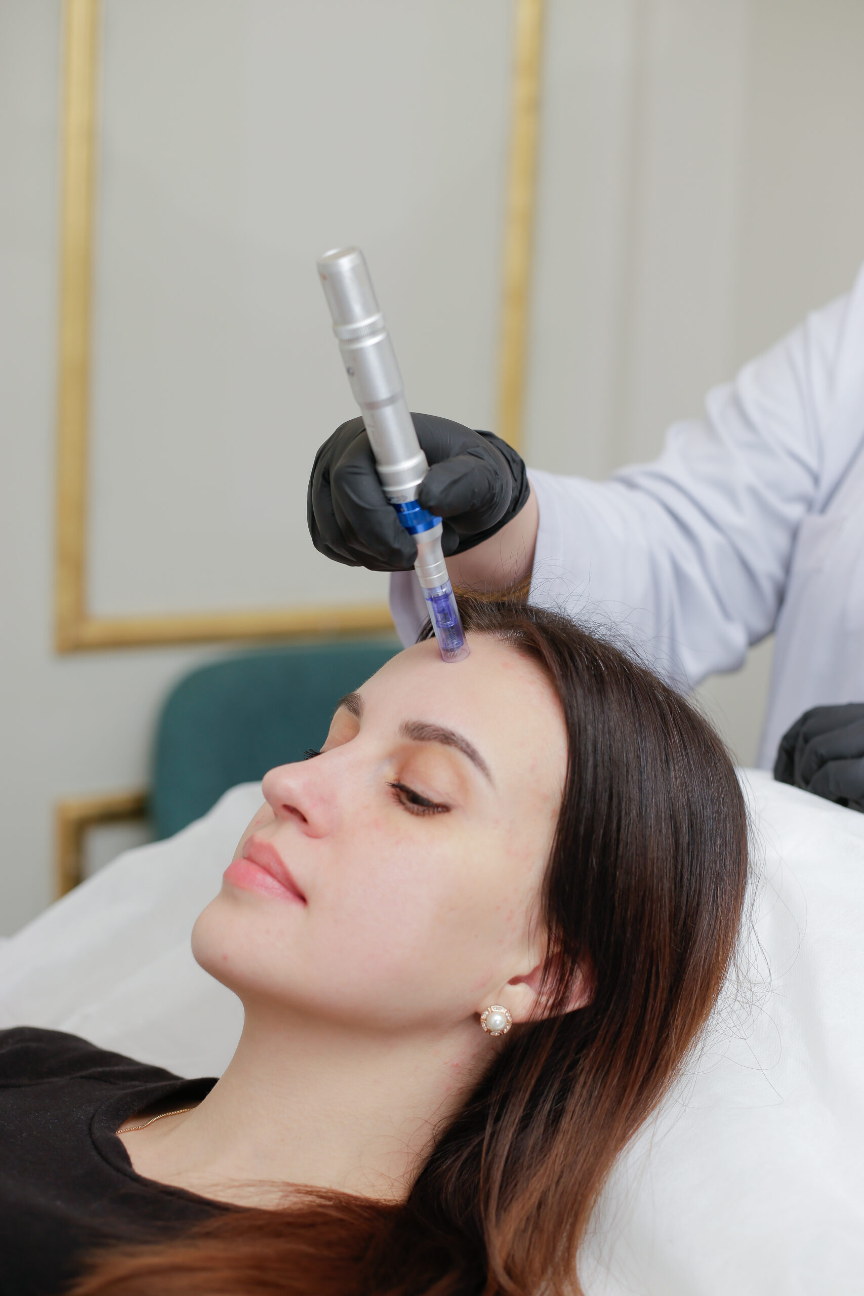 Microneedling