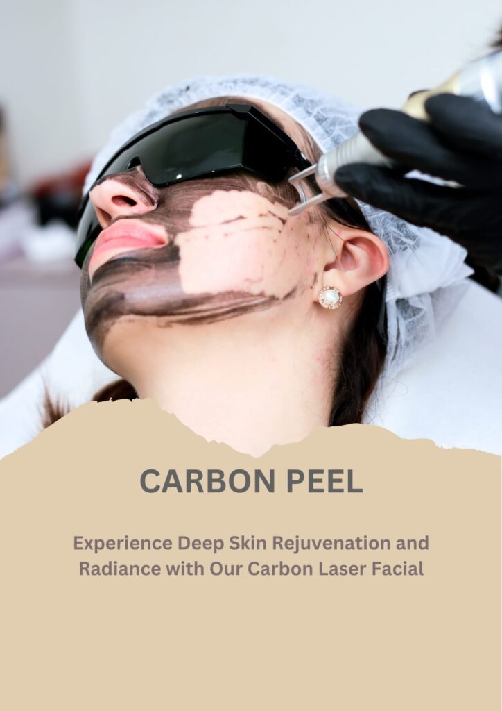 carbon facial