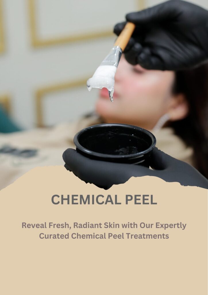 chemical peel
