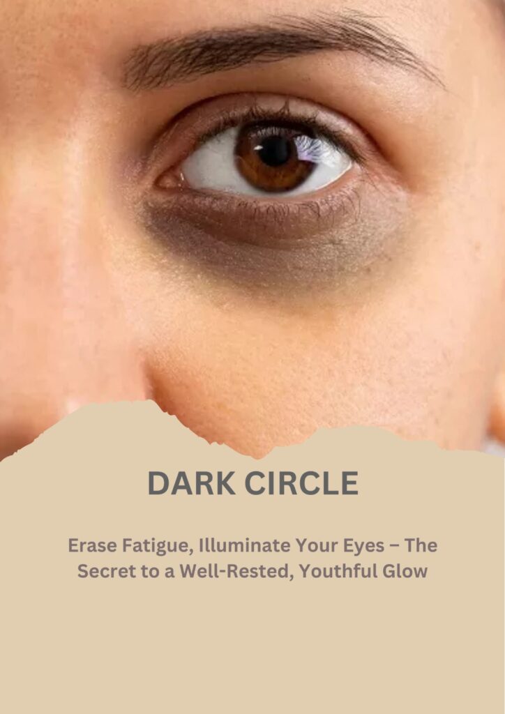 dark circles