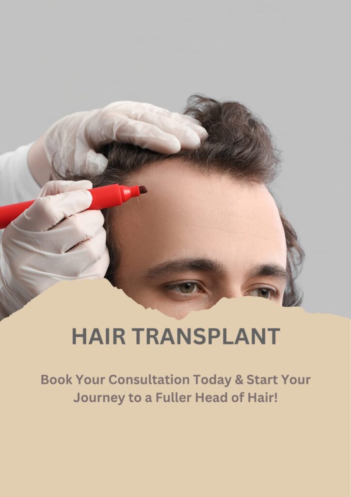 hair transplant
