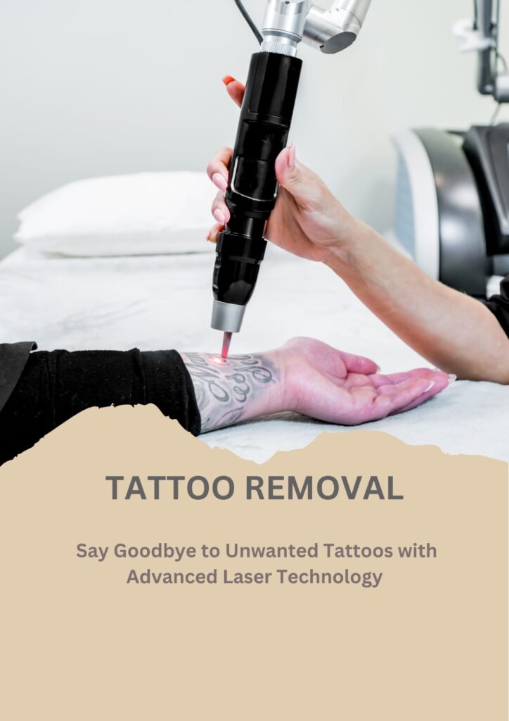 tatoo removal