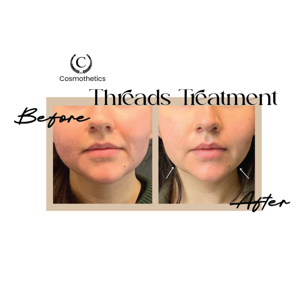 before / after