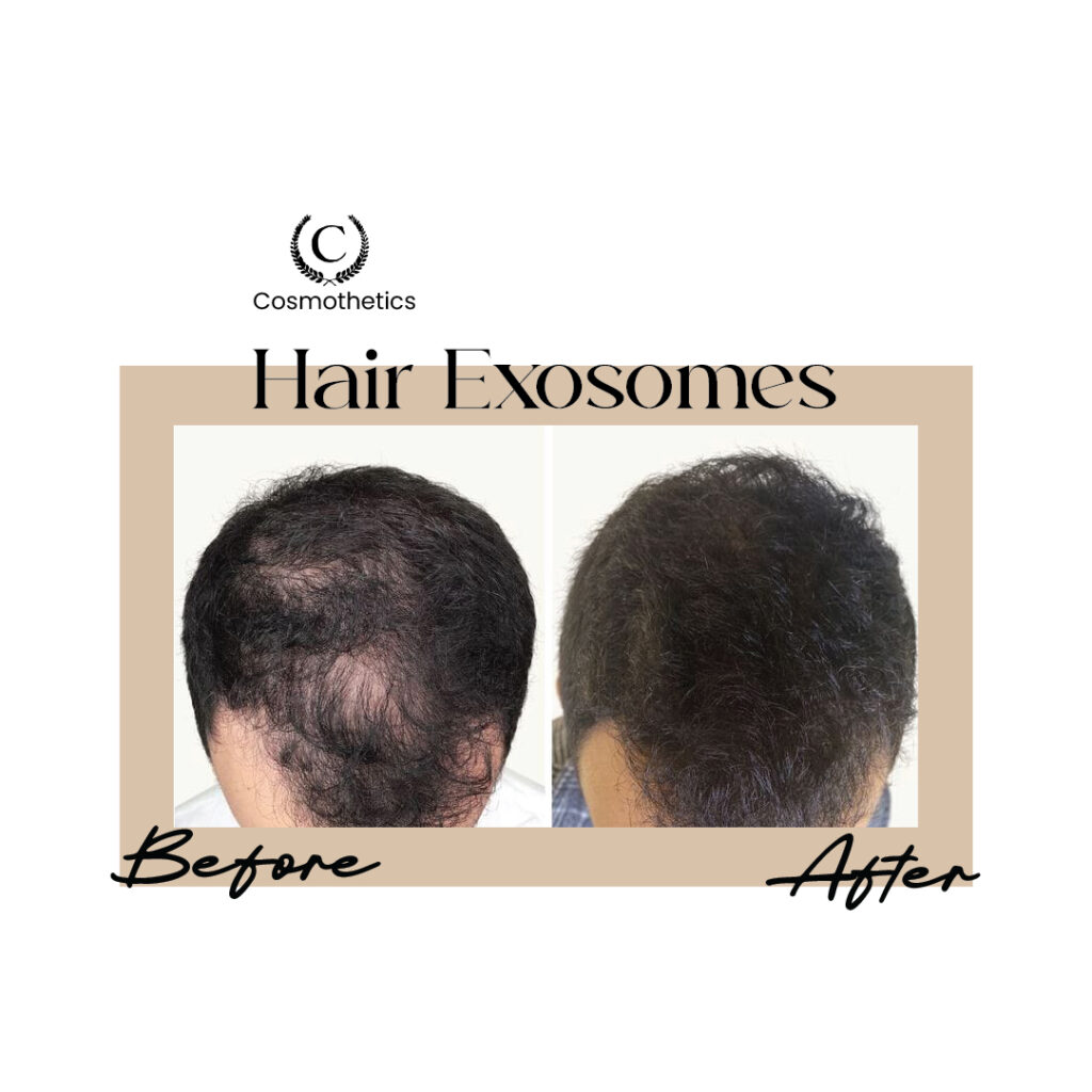 before / after