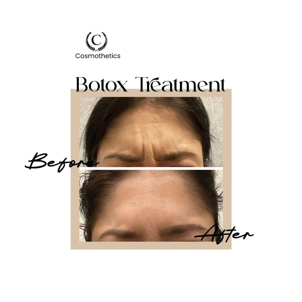 before / after