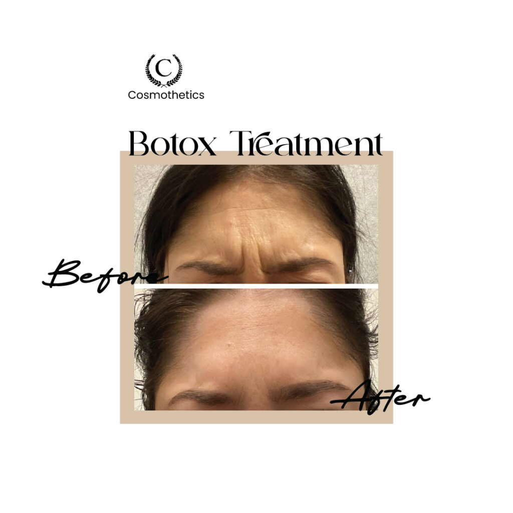 before / after