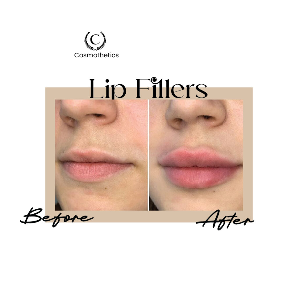 before / after