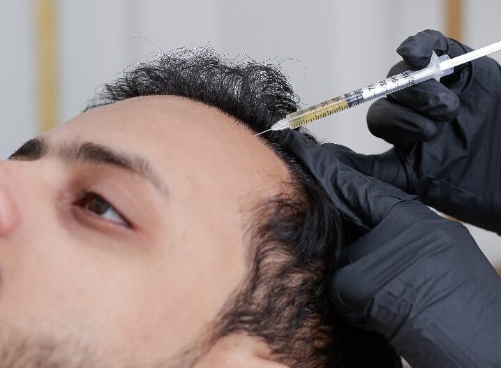 Laser Hair Removal Near Me: Achieve Smooth Skin with Cosmothetics in Lahore