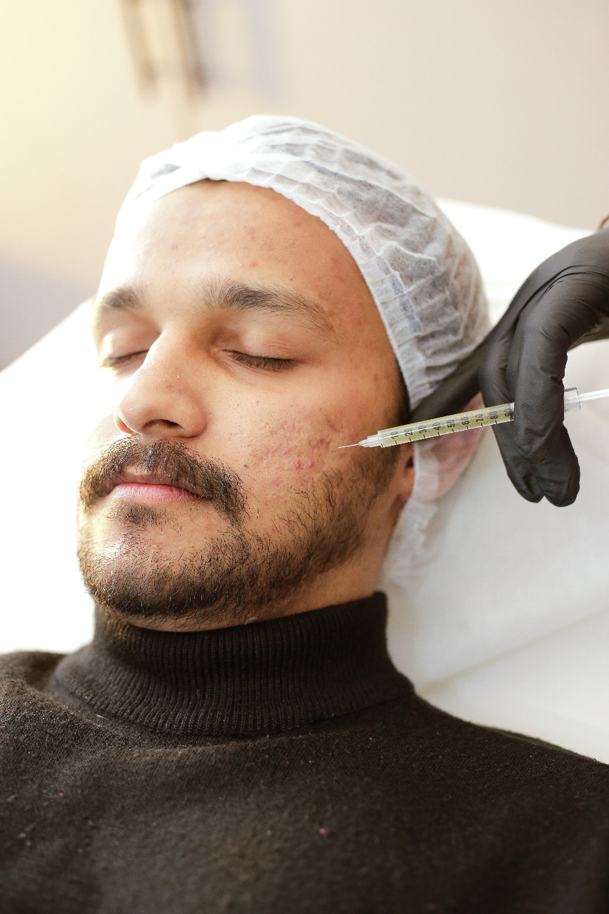 Steps of HydraFacial – Complete Guide by Cosmothetics, Lahore