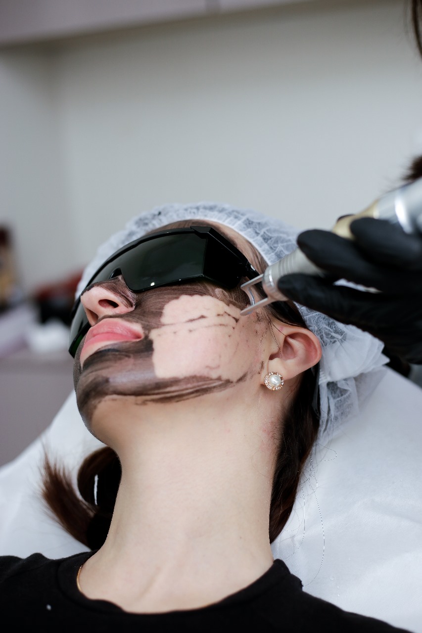 Cosmo Laser Clinic – Advanced Laser Treatments at Cosmothetics, Lahore