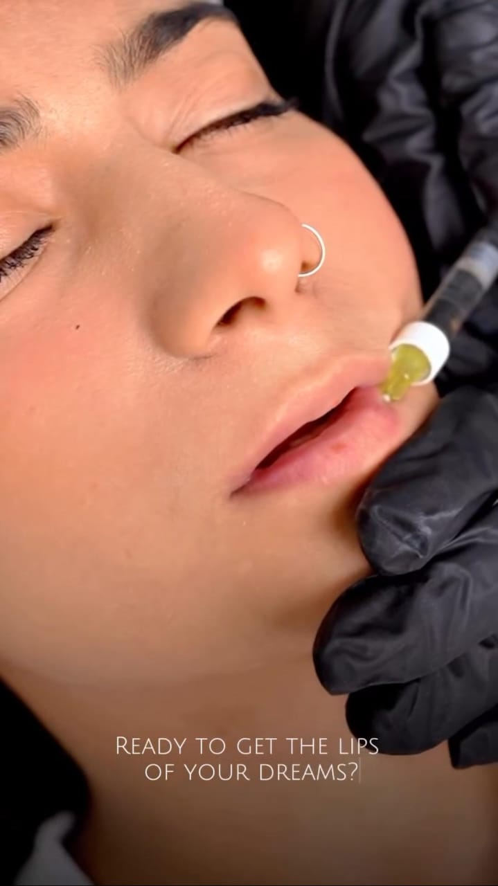 Best Aesthetic Clinic In Lahore | Aesthetic Clinic Near Me