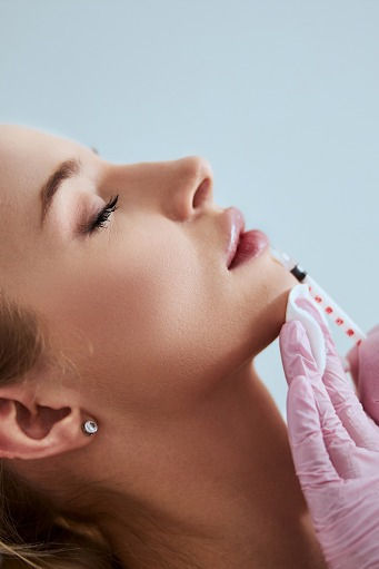 Best Lip Fillers Treatment in Lahore – Cosmothetics