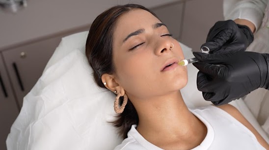 lip filler treatment in lahore