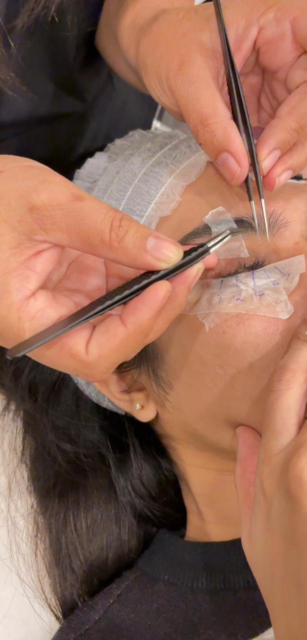 exosomes treatment in lahore