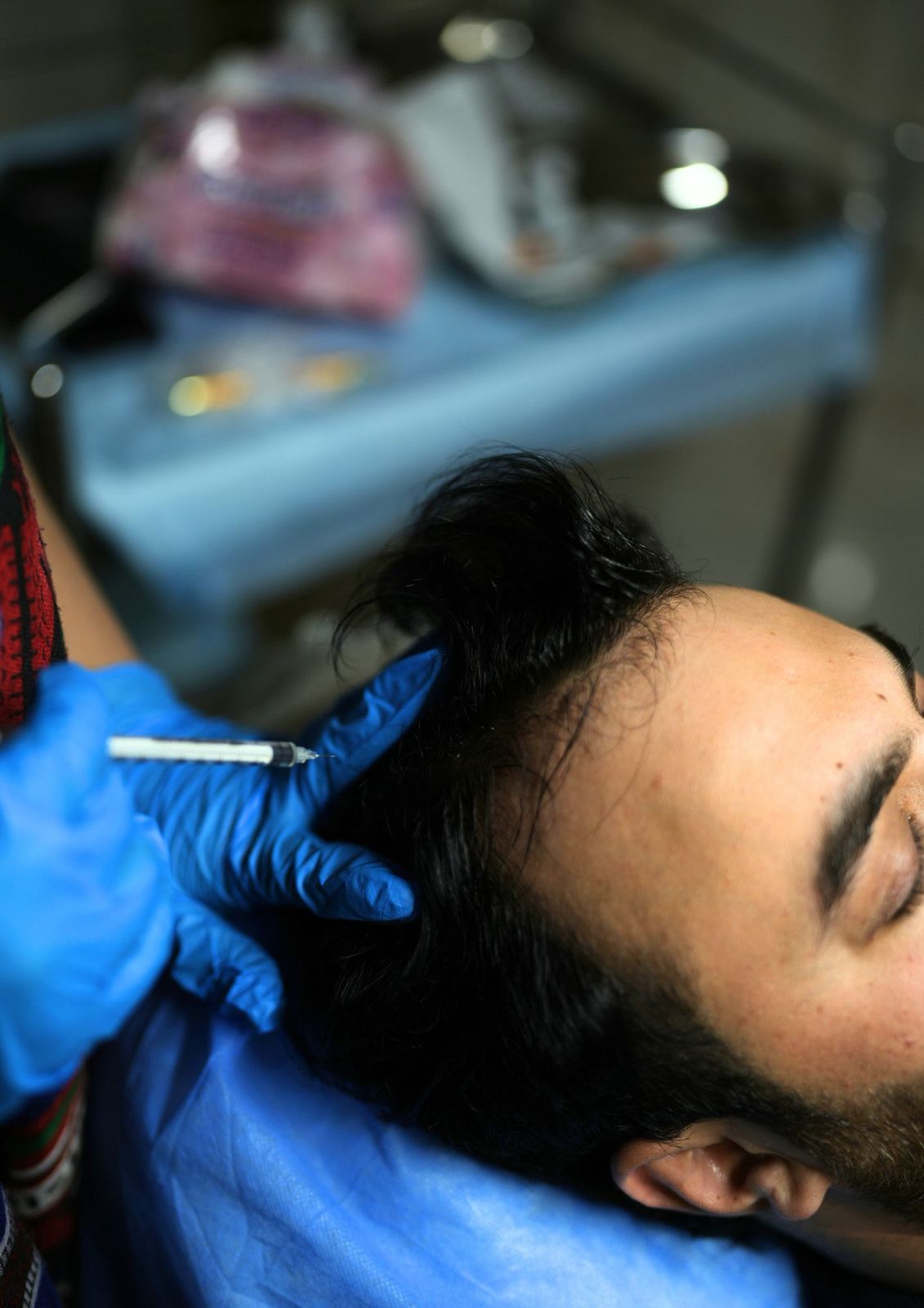 Exosomes Hair Treatment Clinic in Lahore