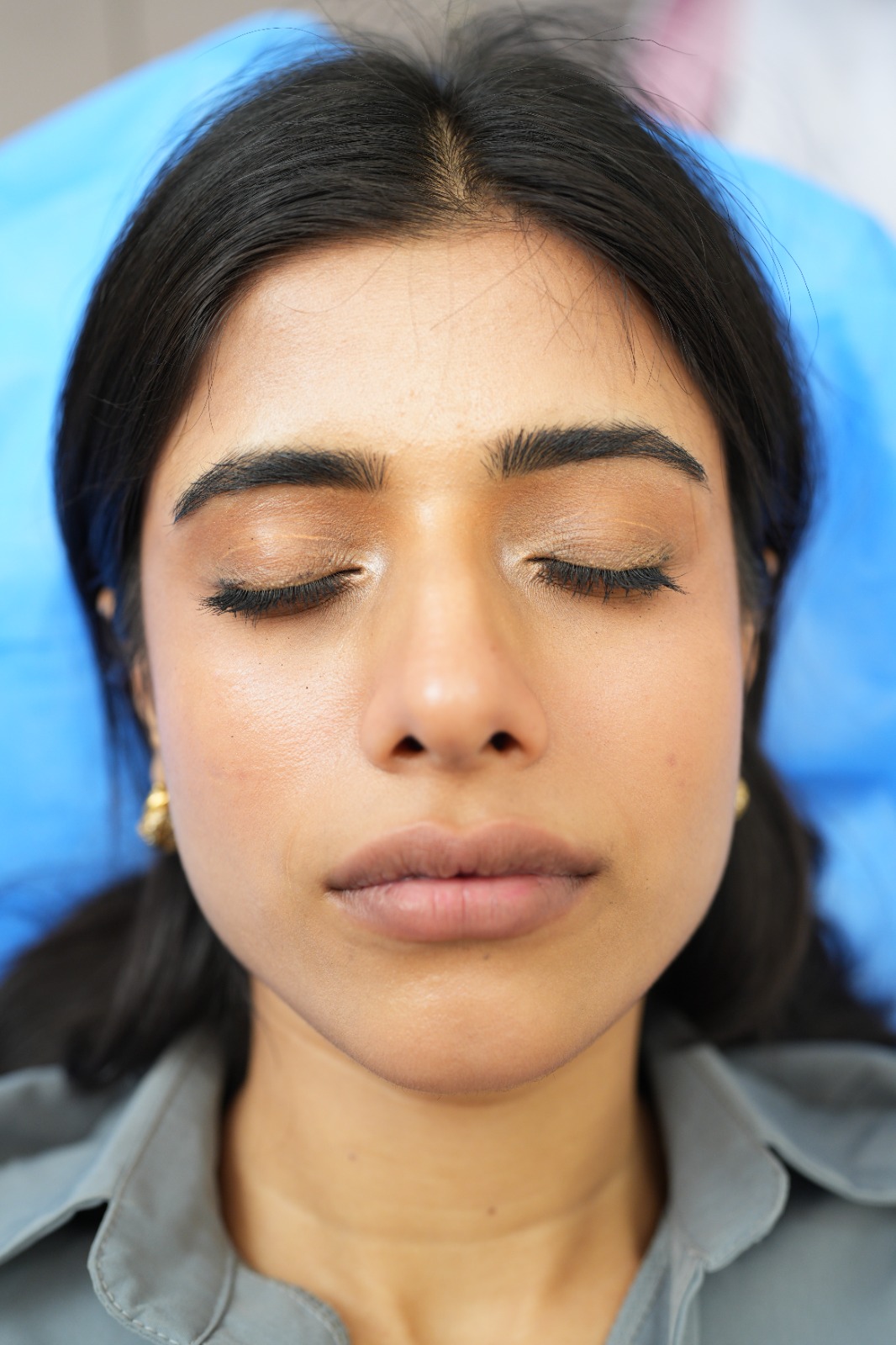 laser clinic near me in lahore