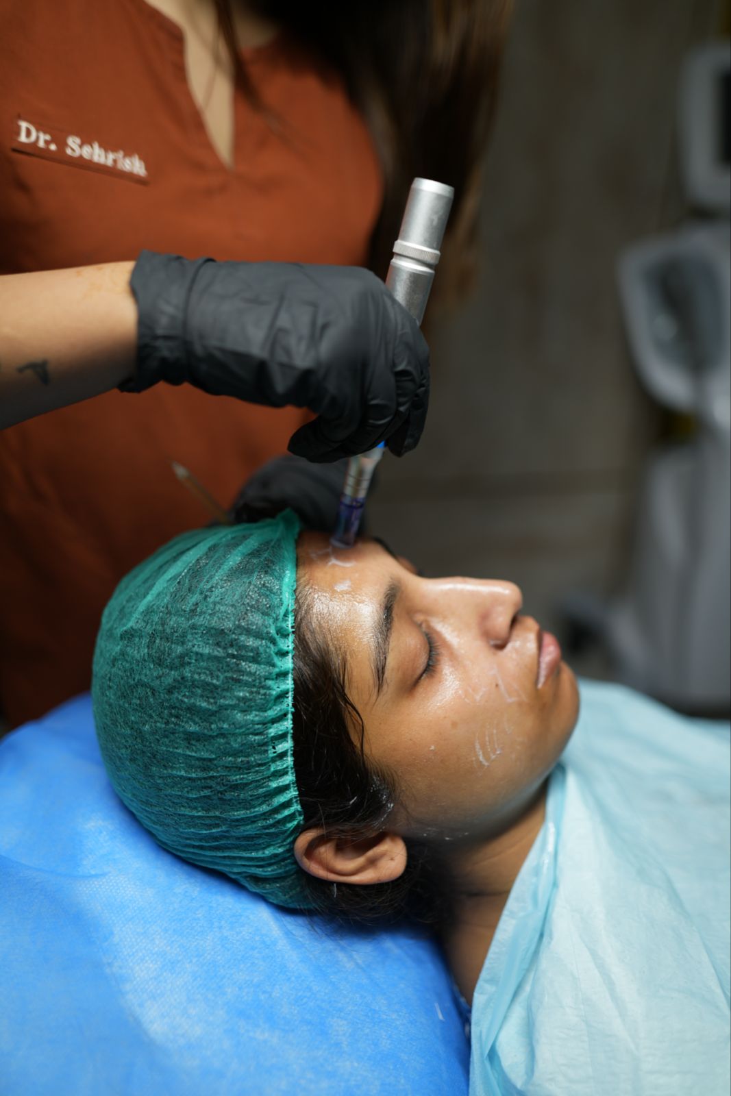 best dermatologist in lahore for acne