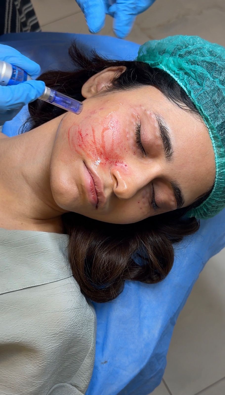 Skin Clinic Lahore Near Thokar Niaz Baig | Cosmothetics Clinic