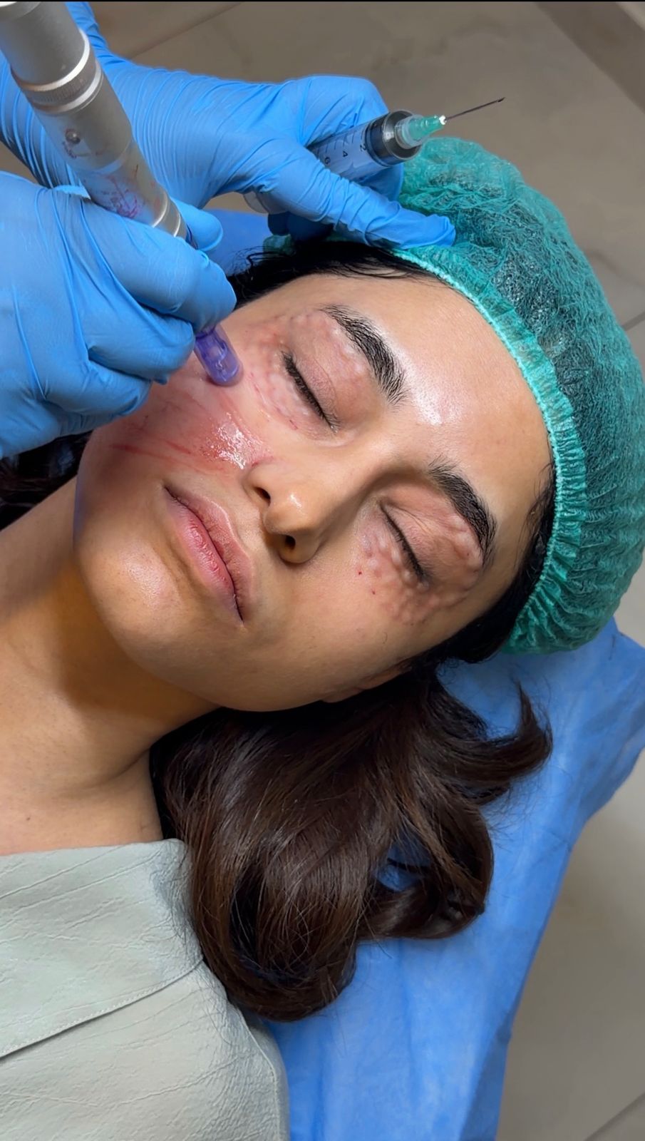 Best Aesthetic Clinic Lahore Near Thokar | Cosmothetics Clinic