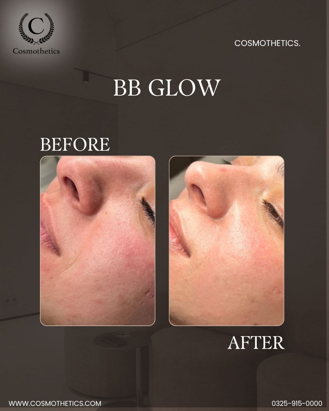 bb glow clinic in johar town lahore